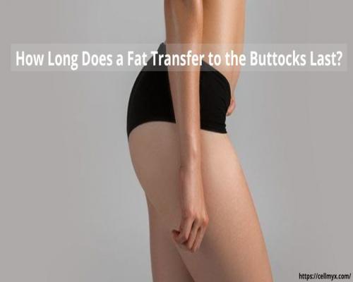  How Long Does a Fat Transfer to the Buttocks Last? 